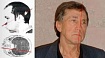 История человека, голову которого пробил луч ускорителя частиц