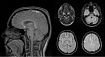 DICOM: цифровые снимки в медицине — ликбез для системного администратора